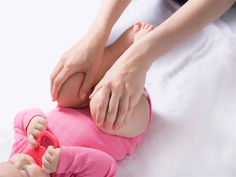 درمان دررفتگی مادرزادی لگن نوزاد